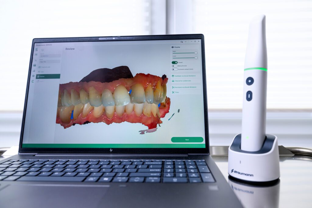 Intraoraalne 3D skäneerimine